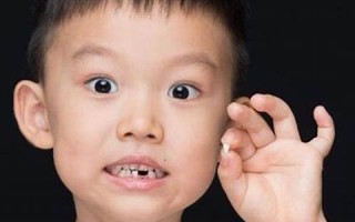 梦见自己掉牙(梦见自己掉牙不出血不疼是什么情况)